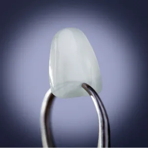Dental Veneers
